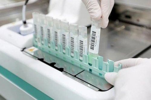 Mất tiền oan từ tờ giấy xét nghiệm ung thư tại nhà