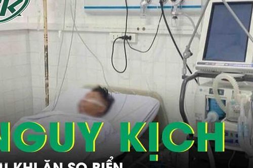 Nguy kịch sau khi ăn so biển nướng