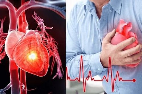 Gia tăng người nhập viện do bệnh tim mạch: Phòng tránh thế nào khi trời trở lạnh?