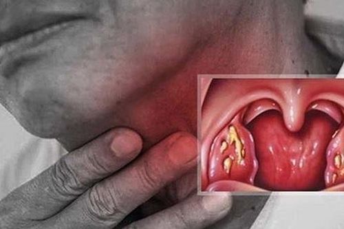 4 loại nước uống tự nhiên làm giảm đau rát họng, viêm họng mùa lạnh