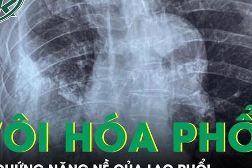 Xẹp phổi, vôi hóa màng phổi - Di chứng nặng nề của lao phổi