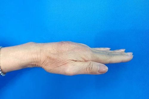 Chuyên gia cảnh báo biến chứng làm đẹp dịp cận Tết