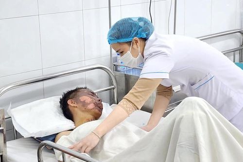 Cảnh báo hậu họa do chế tạo, sử dụng pháo nổ trái phép