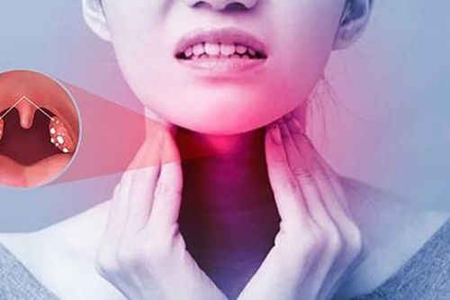 Những biến chứng của viêm họng cấp tính mùa lạnh