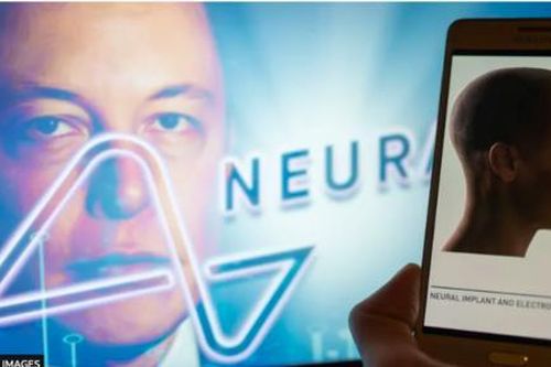 Công ty của Elon Musk lần đầu cấy chip không dây vào não người