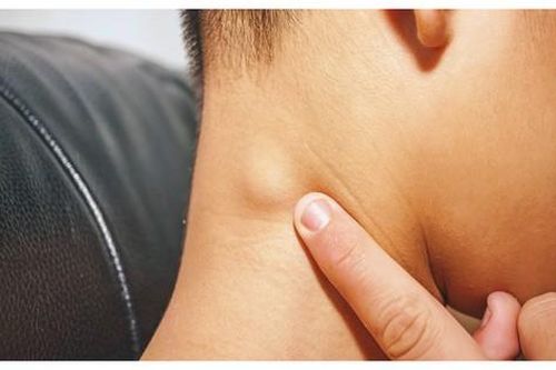 Trẻ nổi hạch có đáng lo, khi nào cần nhập viện?