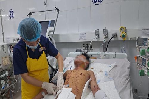 Nhiều trường hợp đa chấn thương nhập viện cấp cứu do pháo nổ