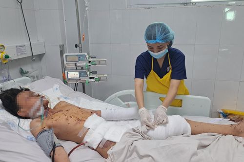 Bé trai 12 tuổi bị thượng nặng do đốt pháo