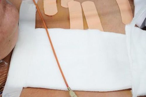 Kích hoạt báo động đỏ cứu chủ quán bị kẻ lạ mặt đâm nhiều nhát để cướp tài sản