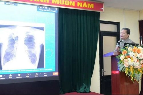 Nấm phổi là căn bệnh có chi phí điều trị và tỷ lệ tử vong rất cao
