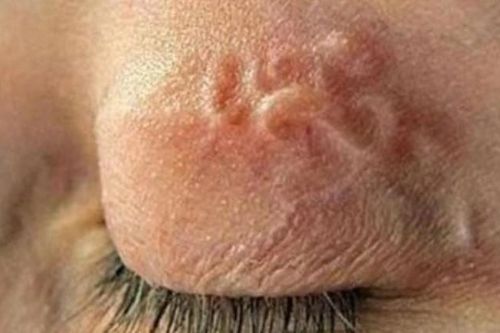 Cảnh báo nguy cơ nhiễm ký sinh trùng từ 'thú cưng'