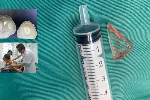 Bé trai có mảnh thủy tinh trong đầu gối gần 2 năm