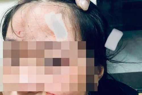 Vụ nữ sinh Hà Nội đánh em lớp dưới: Buộc thôi học 6 ngày