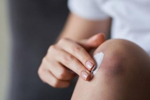 Vết bầm tím, chảy máu do dùng thuốc có nguy hiểm?