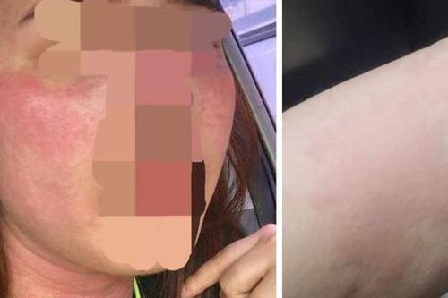 Làm đẹp đón Tết và cái kết 'đắng'
