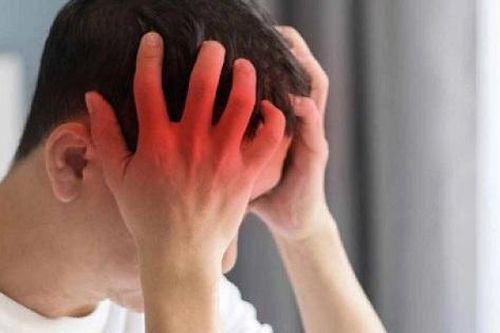 Thiếu máu não thoáng qua làm sao phân biệt với bệnh lý khác?