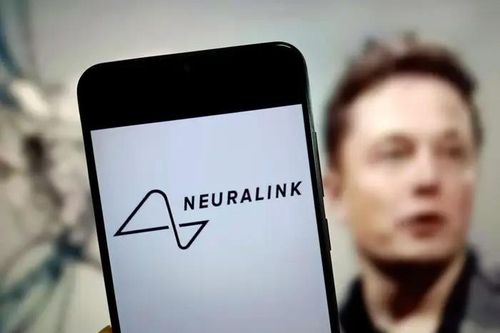 Chip cấy não của Elon Musk lộ khả năng đặc biệt