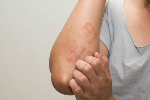 Dấu hiệu cảnh báo cần đi khám ký sinh trùng