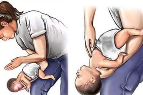 Tai nạn thương tích hay gặp ở trẻ dịp Tết và cách sơ cứu, phòng tránh