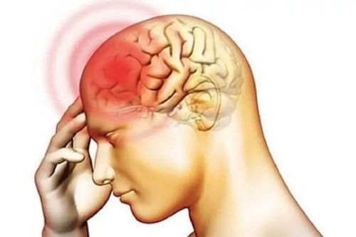 Bác sĩ trả lời: Bị tái phát u màng não thái dương, xạ trị dứt điểm được không?