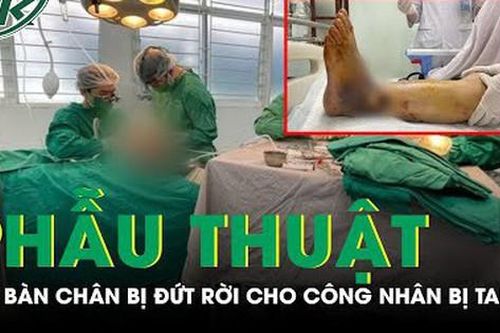 Nối bàn chân đứt rời cho công nhân bị tai nạn lao động