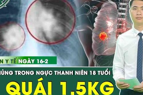Tổng hợp những thông tin y tế nóng nhất ngày 16/2