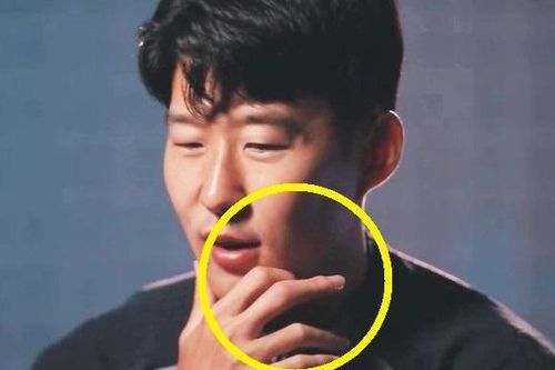 Hình ảnh gây sốt về chấn thương của Son Heung-min