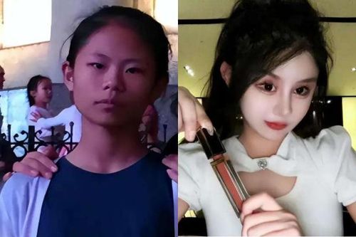 Phẫu thuật 'quá độ', cô gái nghiện làm đẹp vô cùng hối hận