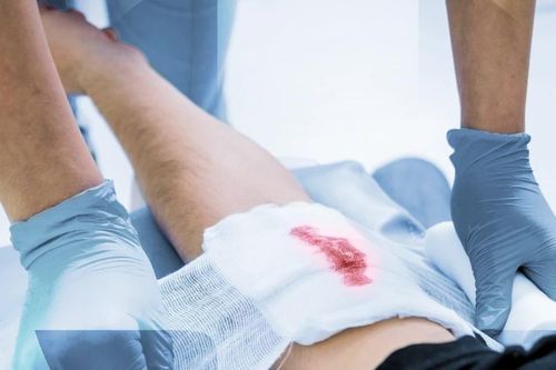 Nghiên cứu đột phá về phương pháp điều trị hiệu quả các vết thương lâu lành