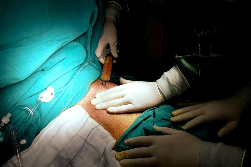 Cấp cứu người đàn ông bị dao đâm thấu bụng