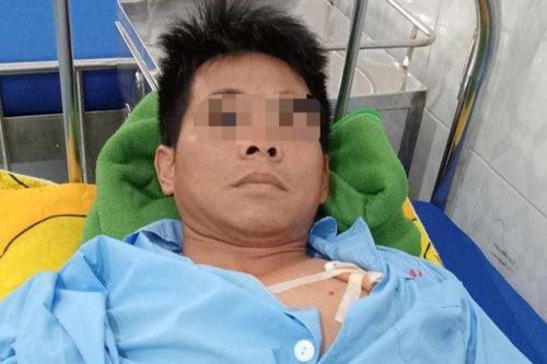 Đắk Lắk: Chó becgie cắn chủ đứt gân tay