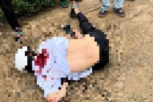Nam sinh lớp 11 bị đâm trọng thương, hai học sinh bị khởi tố
