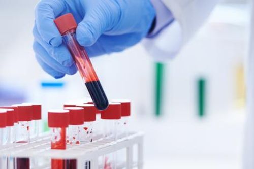 5 xét nghiệm máu thiết yếu nên thực hiện hàng năm