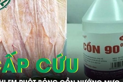 Xót xa 2 chị em ruột cùng cấp cứu vì bỏng cồn nướng mực
