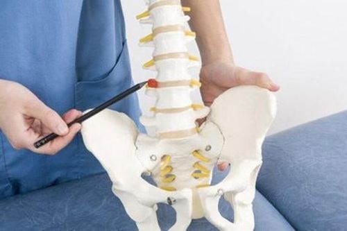 4 giai đoạn của bệnh thoái hóa cột sống thắt lưng và phương pháp điều trị