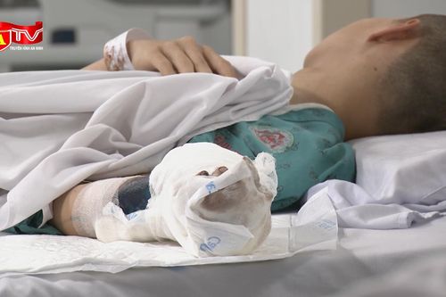 Tai nạn do pháo để lại di chứng cả đời