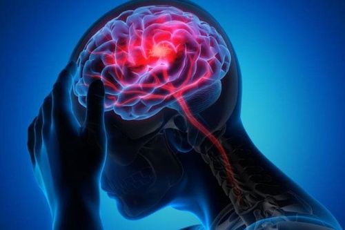 Bác sĩ trả lời: Bị nang màng nhện thái dương phải lồi mắt có mổ được không?