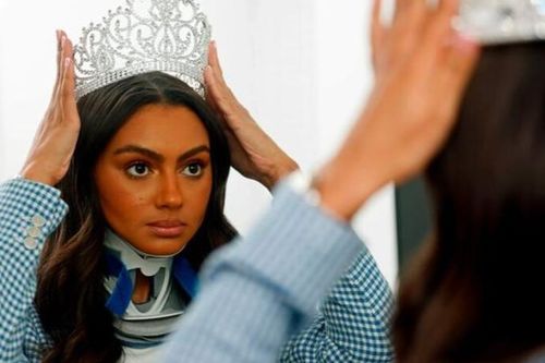 Ứng viên mạnh 22 tuổi ở Miss World từng gãy xương cổ và xương chậu