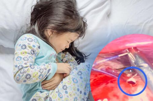 Cảnh báo tình trạng thủng dạ dày ở trẻ em từ thói quen nhiều người mắc phải
