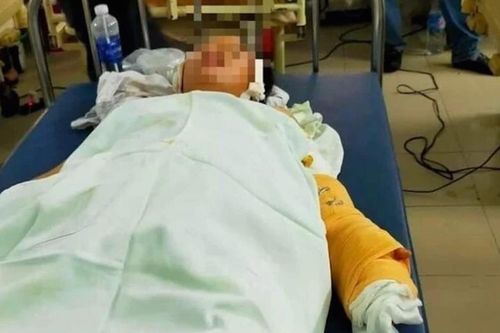Mâu thuẫn tình cảm nam thanh niên đâm trọng thương 2 mẹ con bạn gái rồi dùng xăng đốt nhà