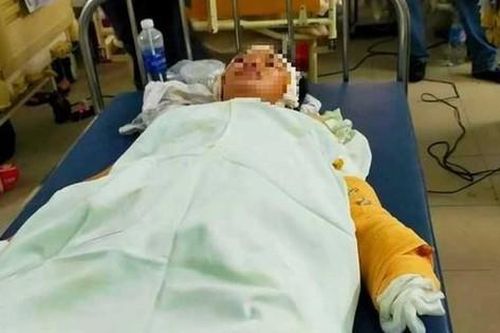 Đâm trọng thương 2 mẹ con người yêu rồi phóng hỏa đốt nhà