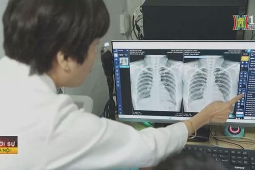 Hết lòng vì người bệnh