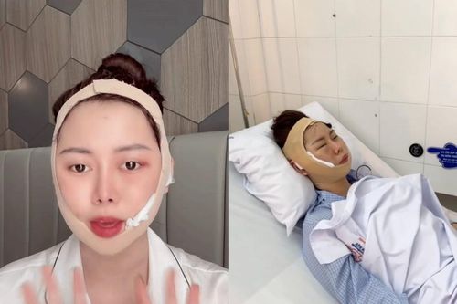 'Chị Google' Việt Phương Thoa biến chứng thẩm mỹ sau 6 năm