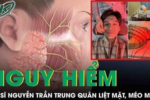Ca sĩ Nguyễn Trần Trung Quân gặp triệu chứng liệt dây thần kinh số 7, méo miệng
