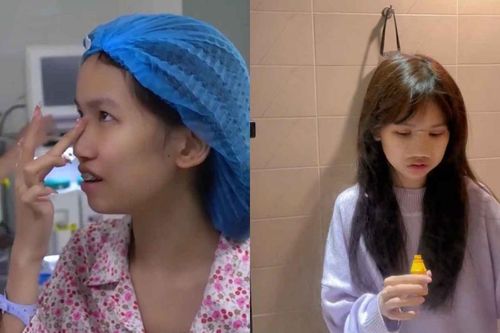 Nữ TikToker 1,3 triệu follow hé lộ quá trình phẫu thuật thẩm mỹ