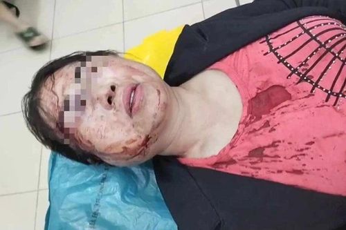 Chồng đánh vợ nhập viện trước ngày ra tòa ly hôn: Thông tin mới nhất