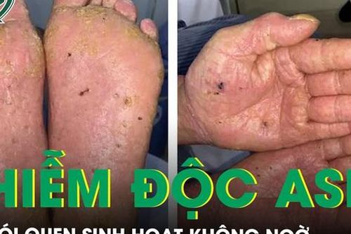 Ung thư tế bào gai, vảy nến, nhiễm độc thạch tín từ thói quen sinh hoạt không ngờ