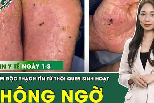 Những thông tin y tế nóng trong ngày 1/3