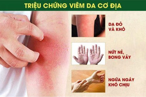 Điều trị viêm da cơ địa ai cũng cần biết