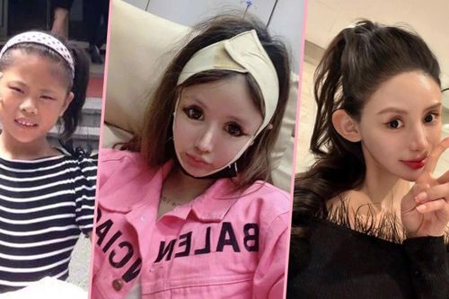 Mới 18 tuổi, cô gái đã 100 lần phẫu thuật thẩm mỹ, tốn gần 14 tỷ đồng